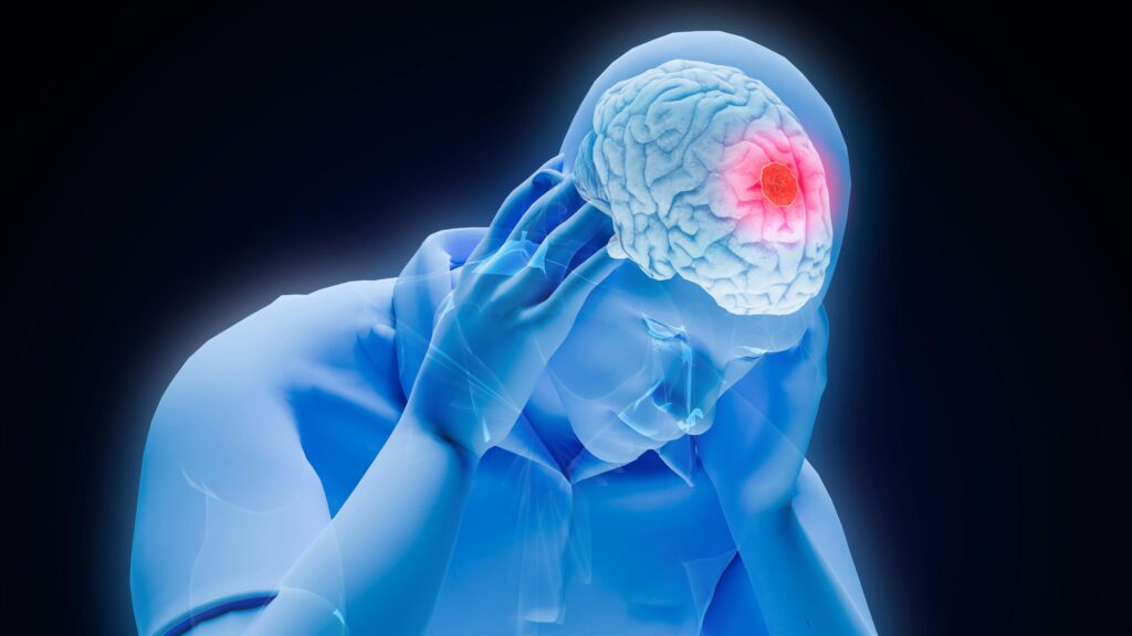 Lesión Cerebral Traumática Después de un Accidente Derechos y Compensación